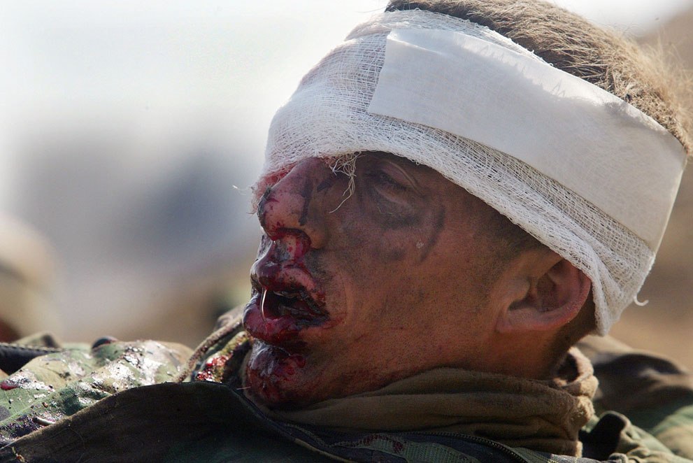 Лейтенант морской пехоты США ждет эвакуации после ранения в южном иракском городе Эн-Насирия, 23 марта 2003 года.